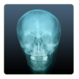 X射线相机 X-Ray Camera 攝影 App LOGO-APP開箱王