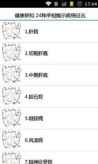 健康新知 24种手相揭示疾病征兆