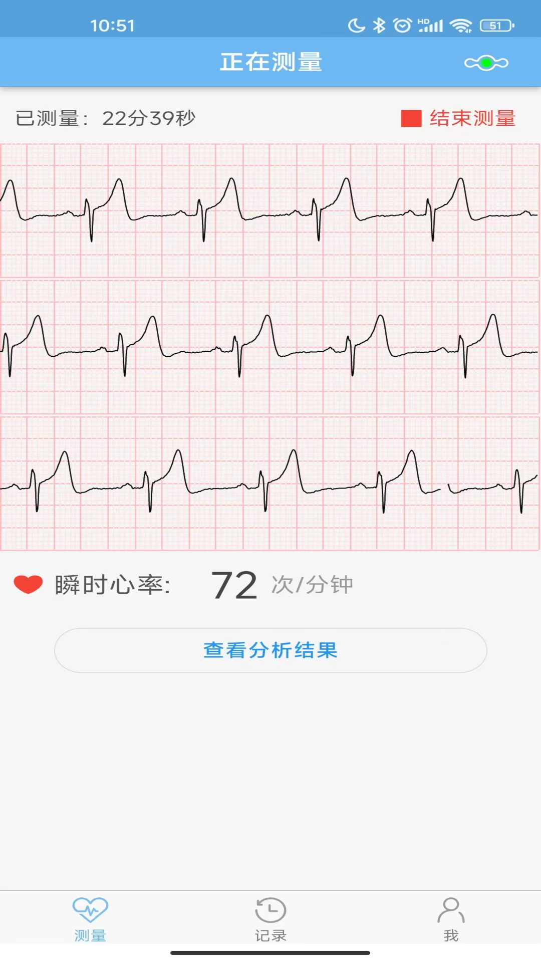 精彩截图-数维康心电2026官方新版