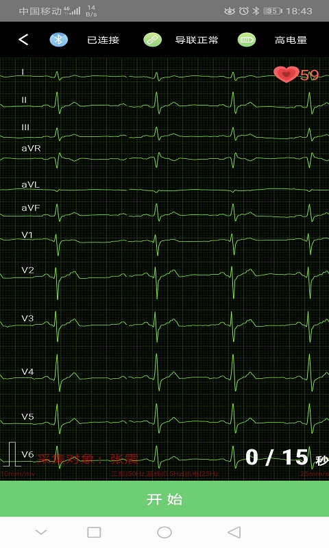 精彩截图-康乃心测心电2024官方新版