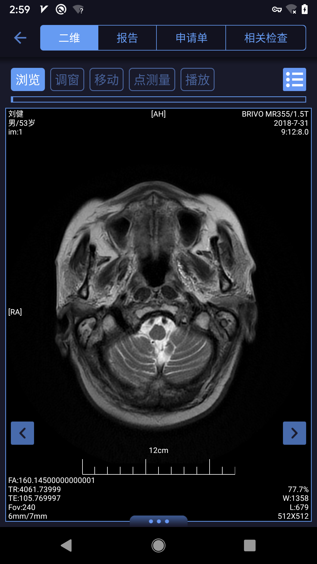 精彩截图-东软睿影2026官方新版