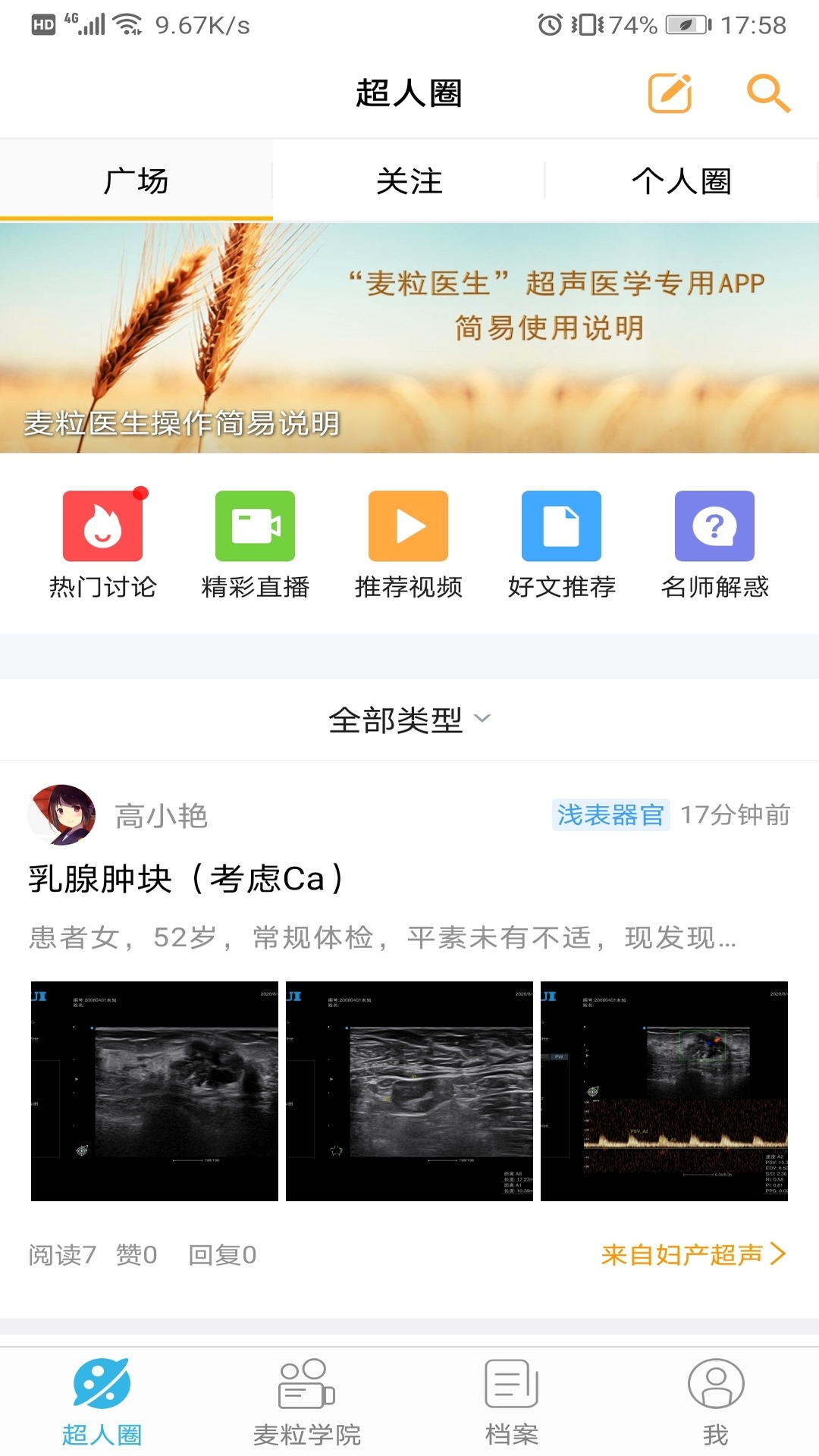 麦粒医生安卓版高清截图
