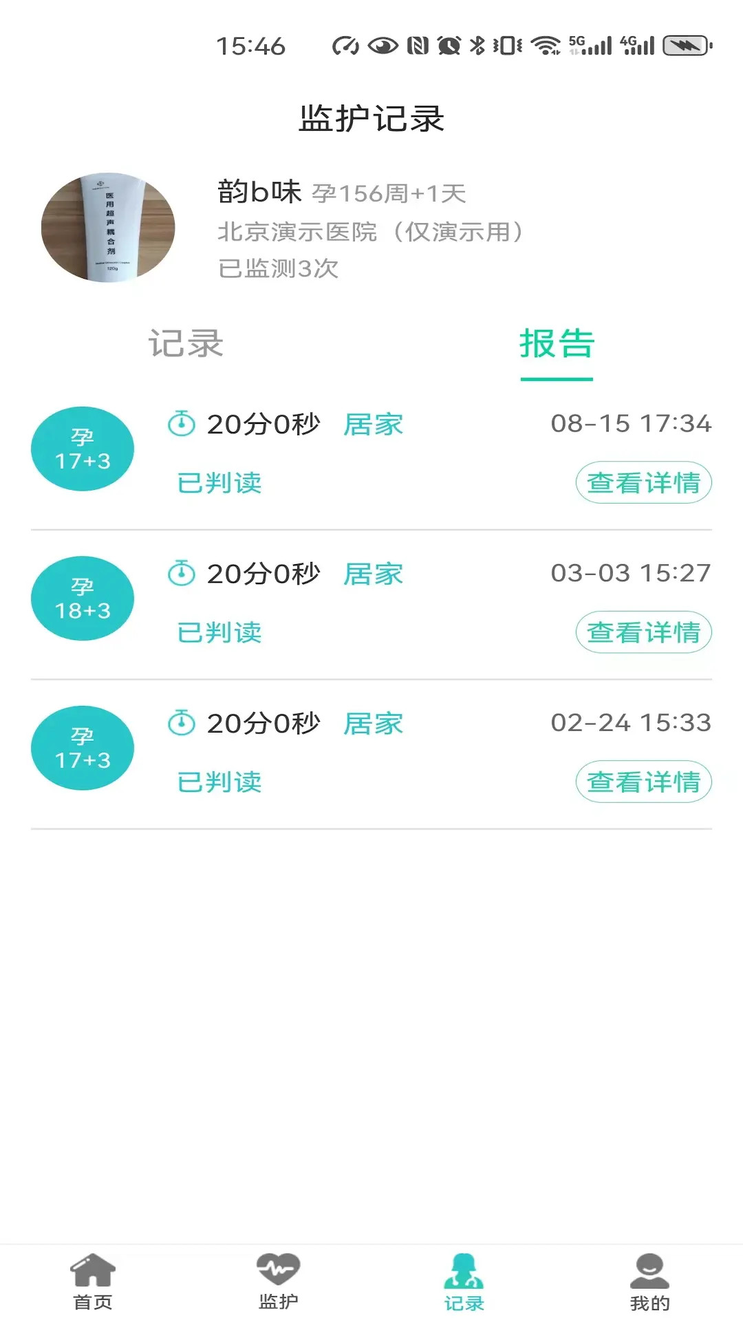 精彩截图-胎心监护2025官方新版