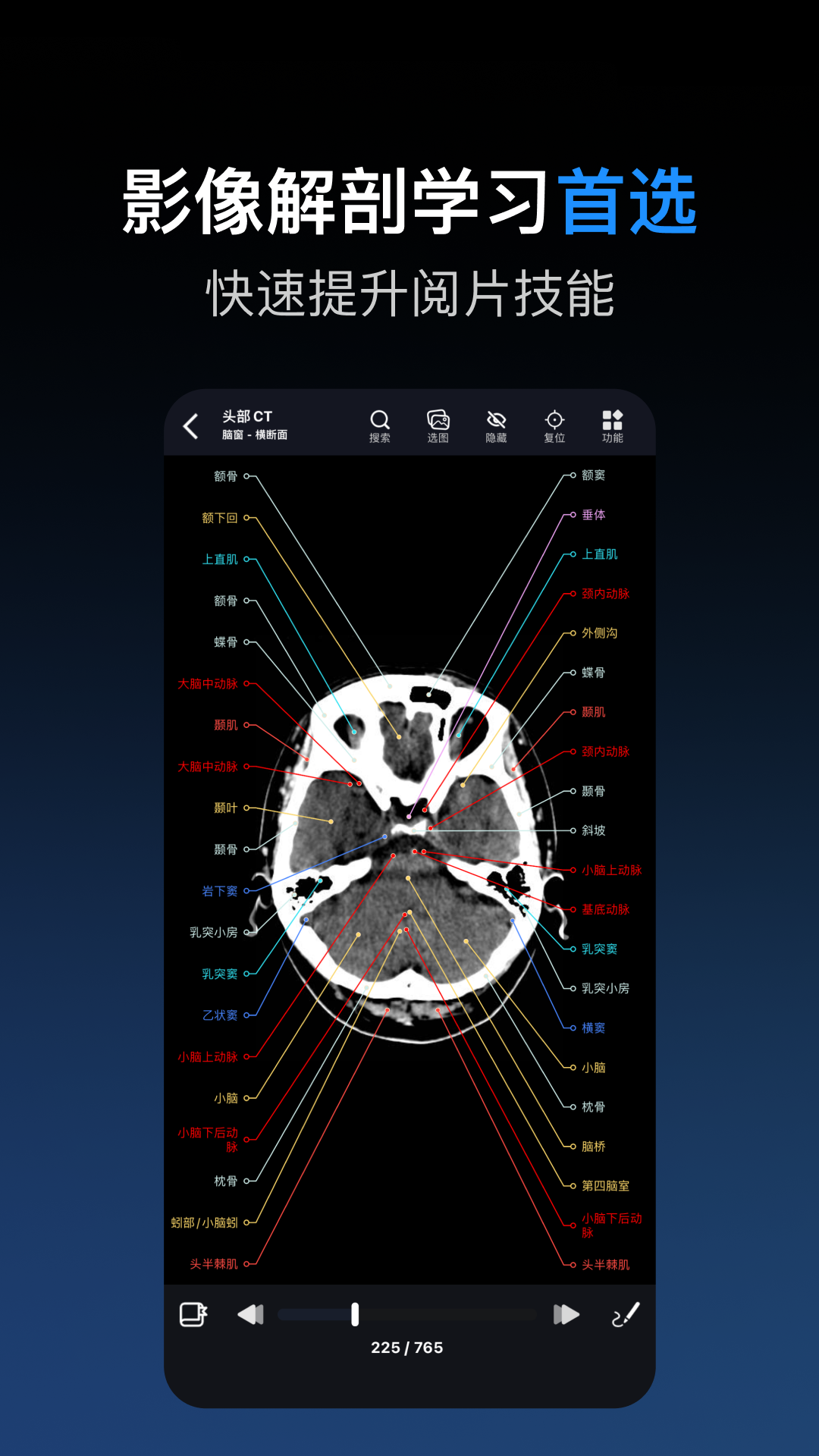 精彩截图-影像解剖图谱2026官方新版