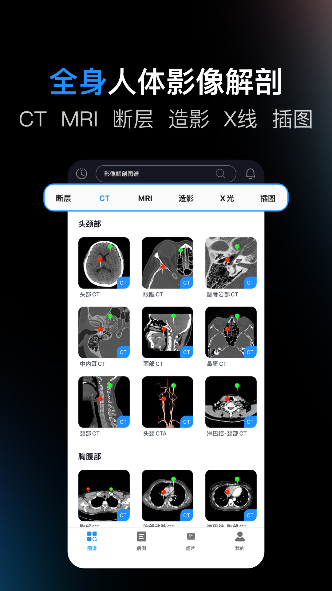 精彩截图-影像解剖图谱2026官方新版