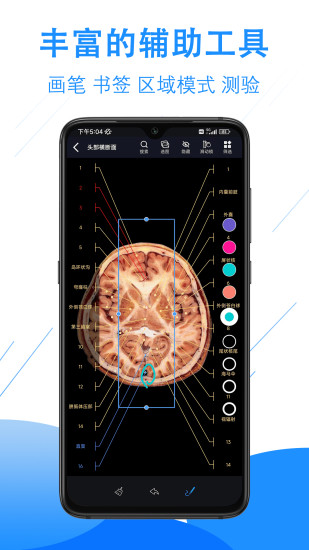 精彩截图-影像解剖图谱2024官方新版