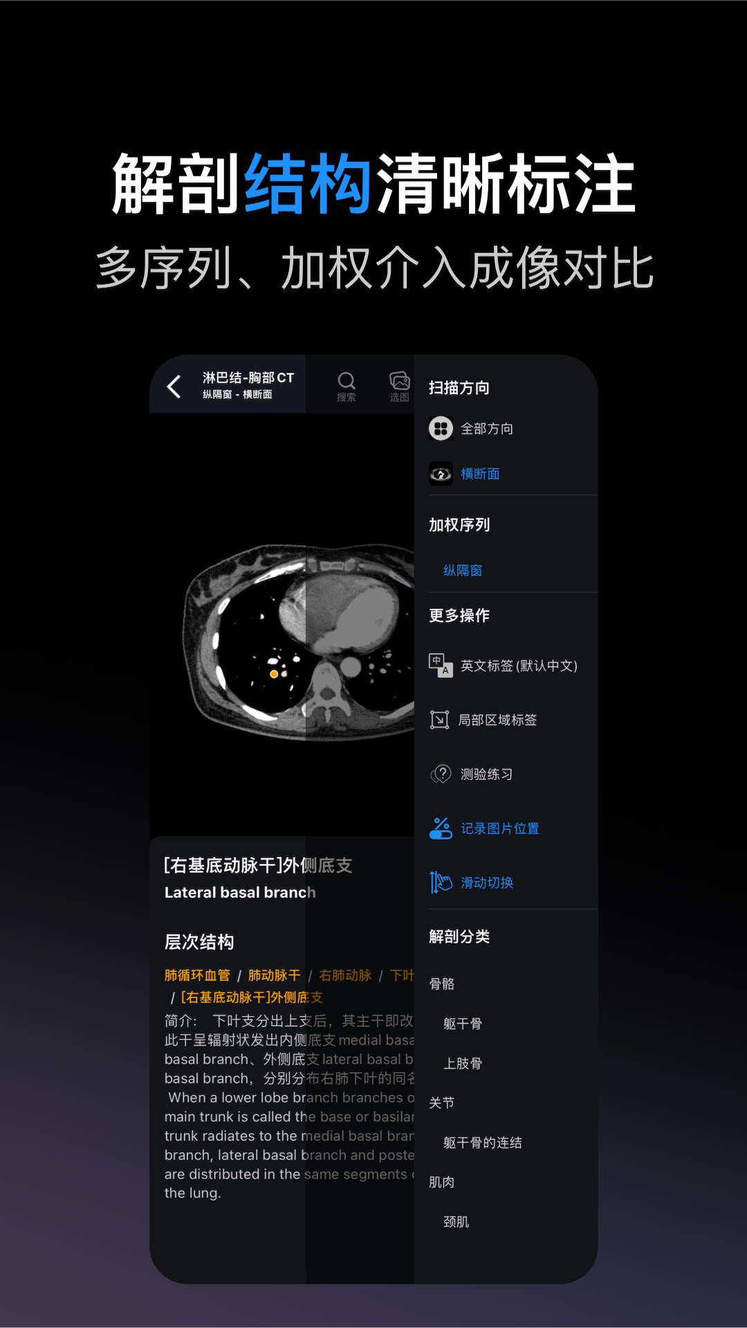 精彩截图-影像解剖图谱2026官方新版