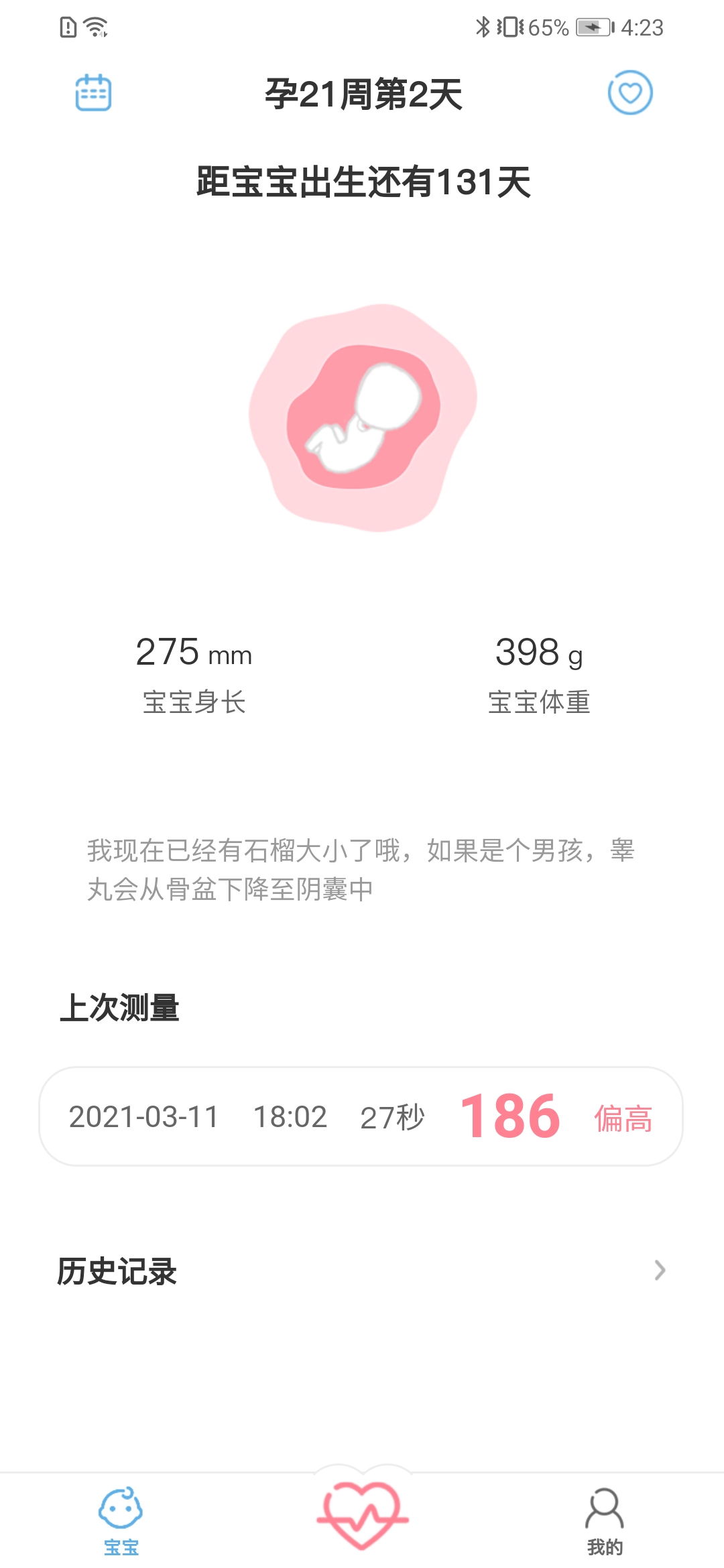 精彩截图-fetalheart胎心仪2025官方新版
