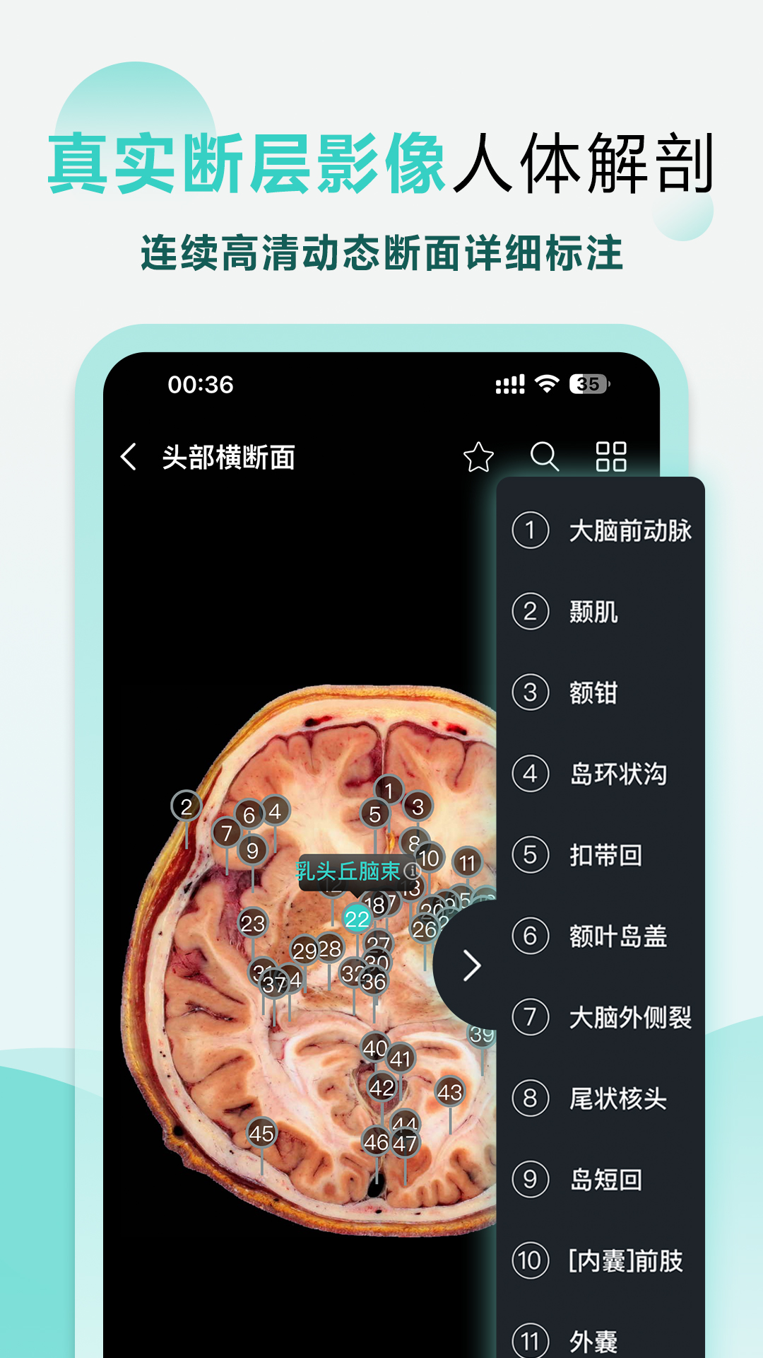 精彩截图-掌上3D解剖2025官方新版