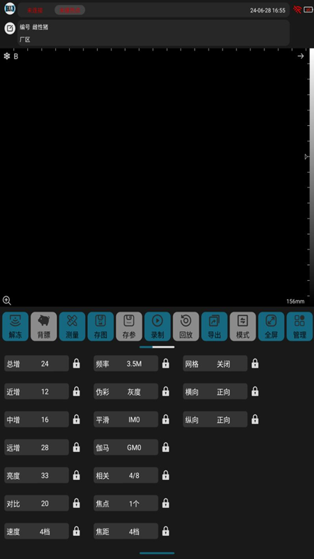 精彩截图-汉德超声2026官方新版