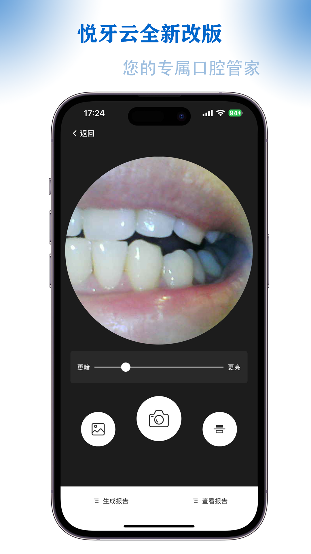 精彩截图-悦牙云2026官方新版