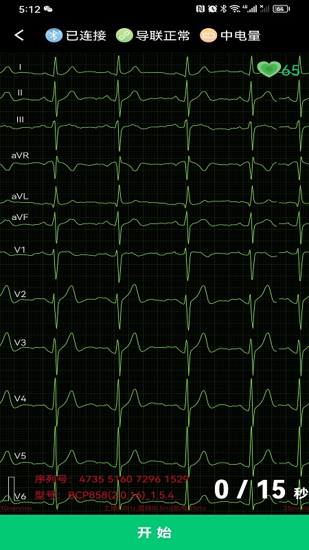 精彩截图-心电一张网2025官方新版