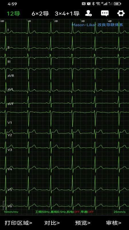 精彩截图-心电一张网2025官方新版