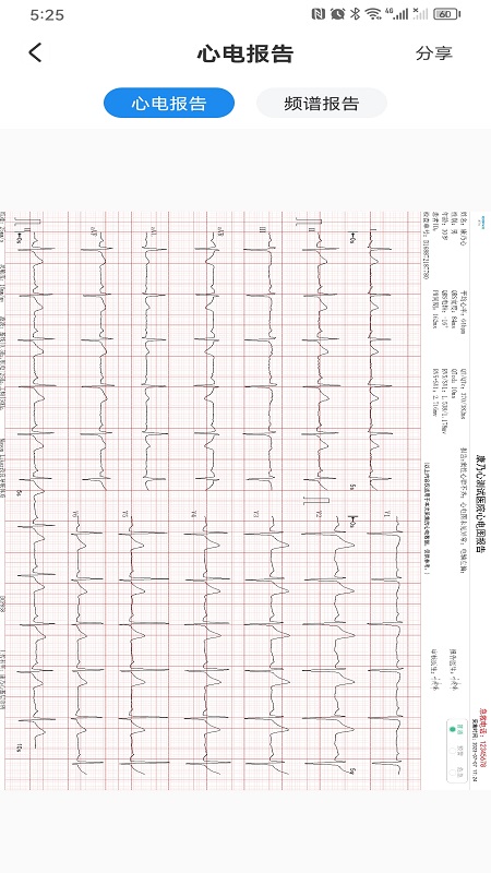 精彩截图-心电一张网2025官方新版