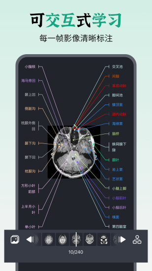 精彩截图-万康人体解剖2024官方新版