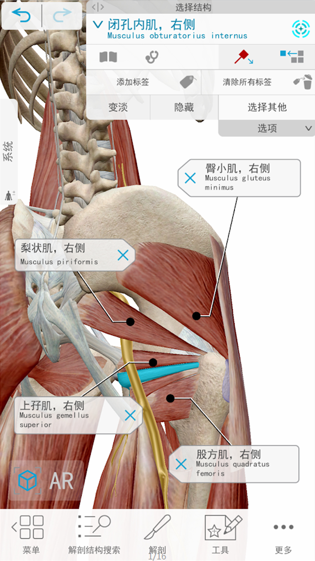 精彩截图-人体解剖 3d2025官方新版