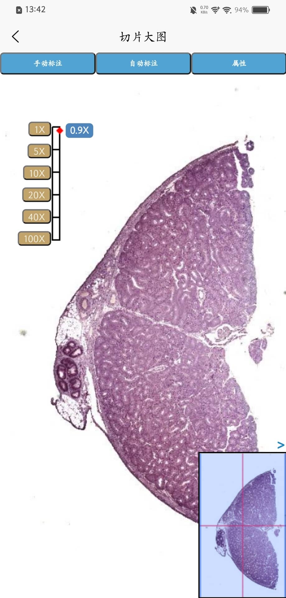 精彩截图-Turingene2026官方新版