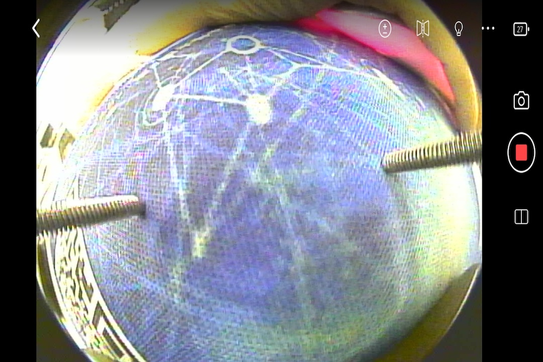 精彩截图-EndoThings2026官方新版