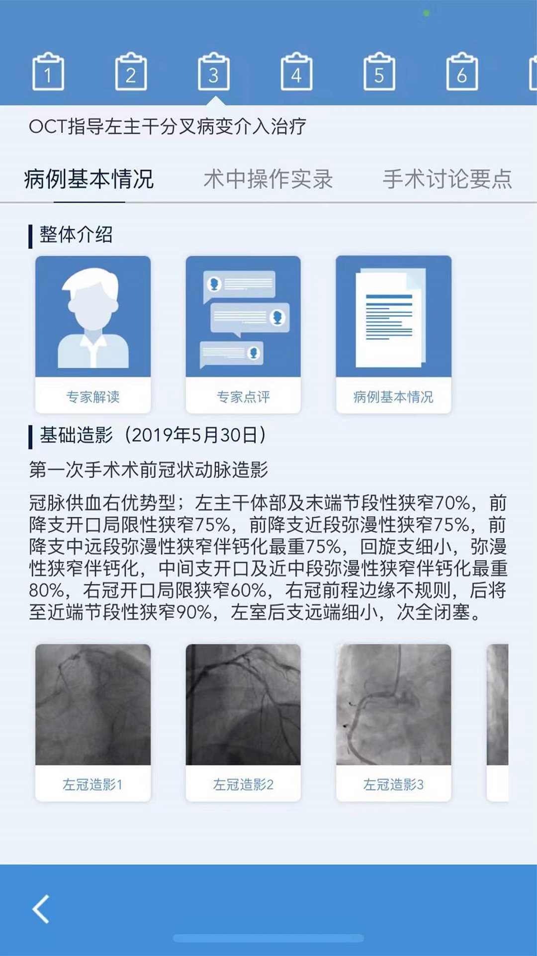 精彩截图-AR PCI2025官方新版