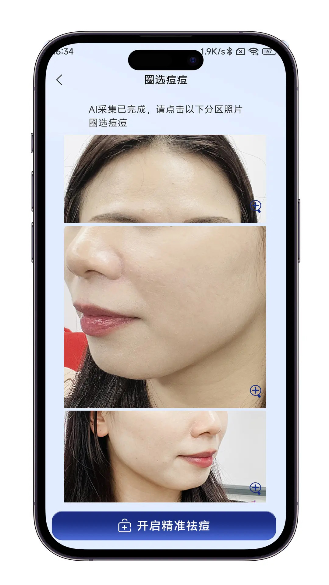 精彩截图-AI皮肤管家2026官方新版