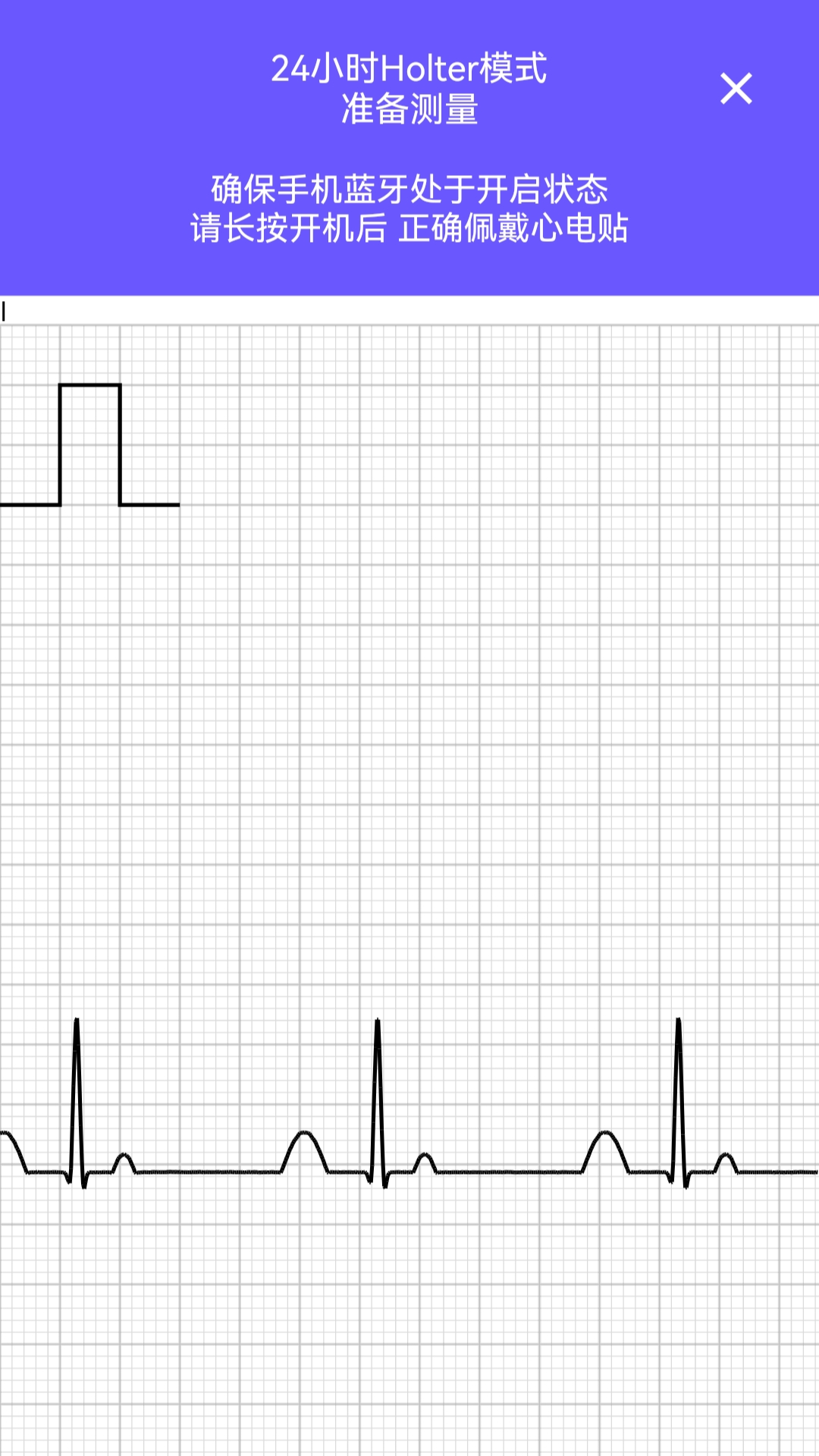 精彩截图-戴乐心心电2026官方新版