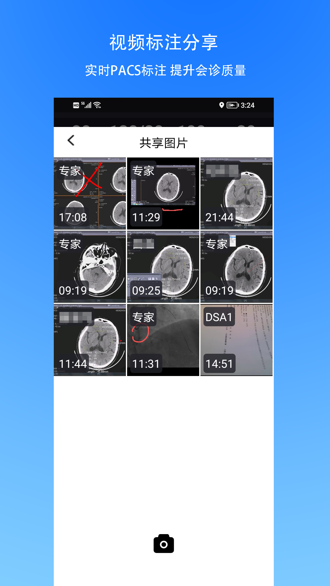 精彩截图-手术指导会诊2026官方新版