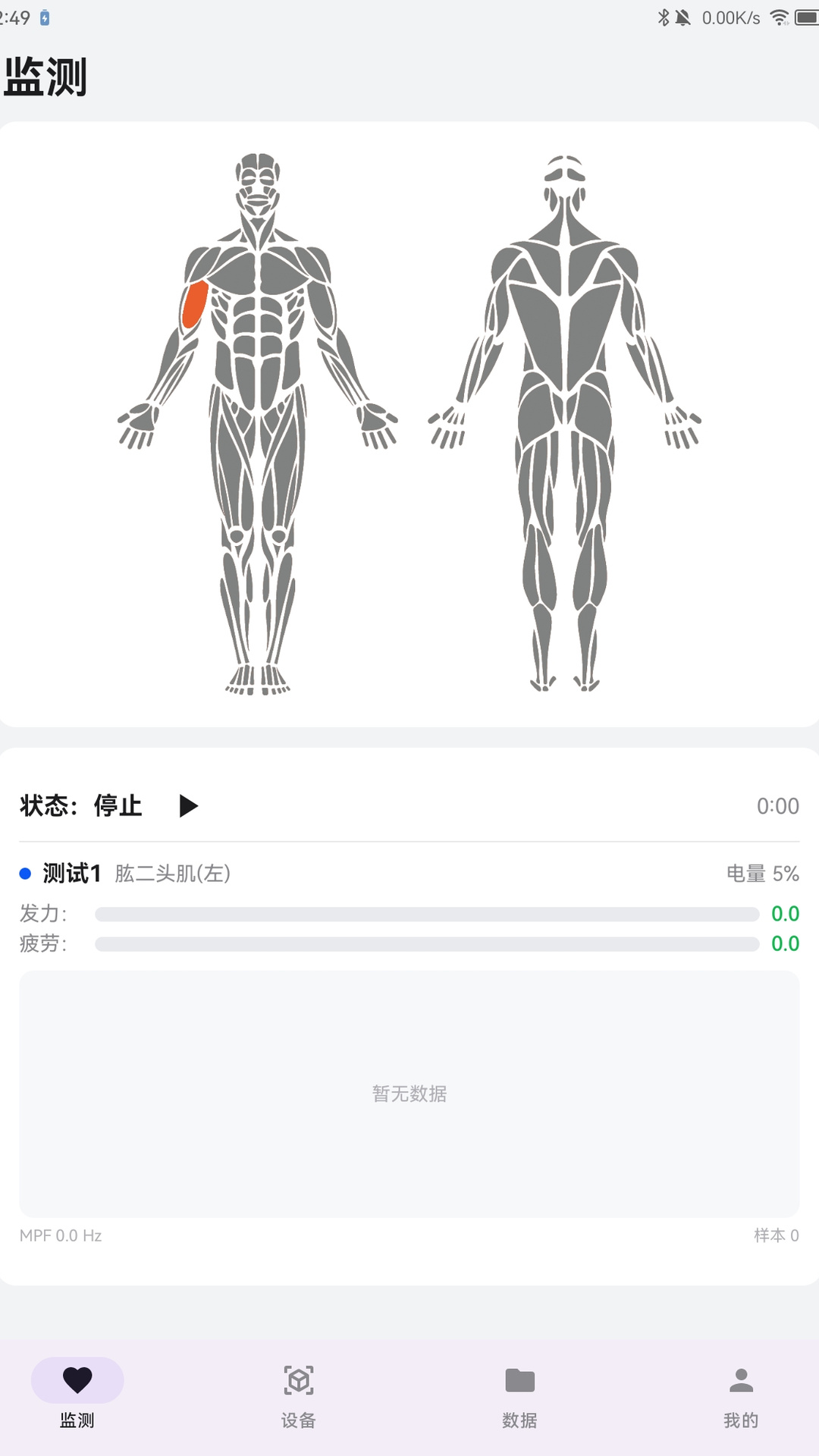 精彩截图-肌电监测2026官方新版