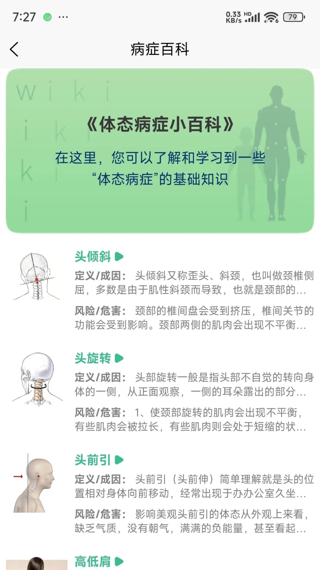 精彩截图-BodyLang体态评估2026官方新版