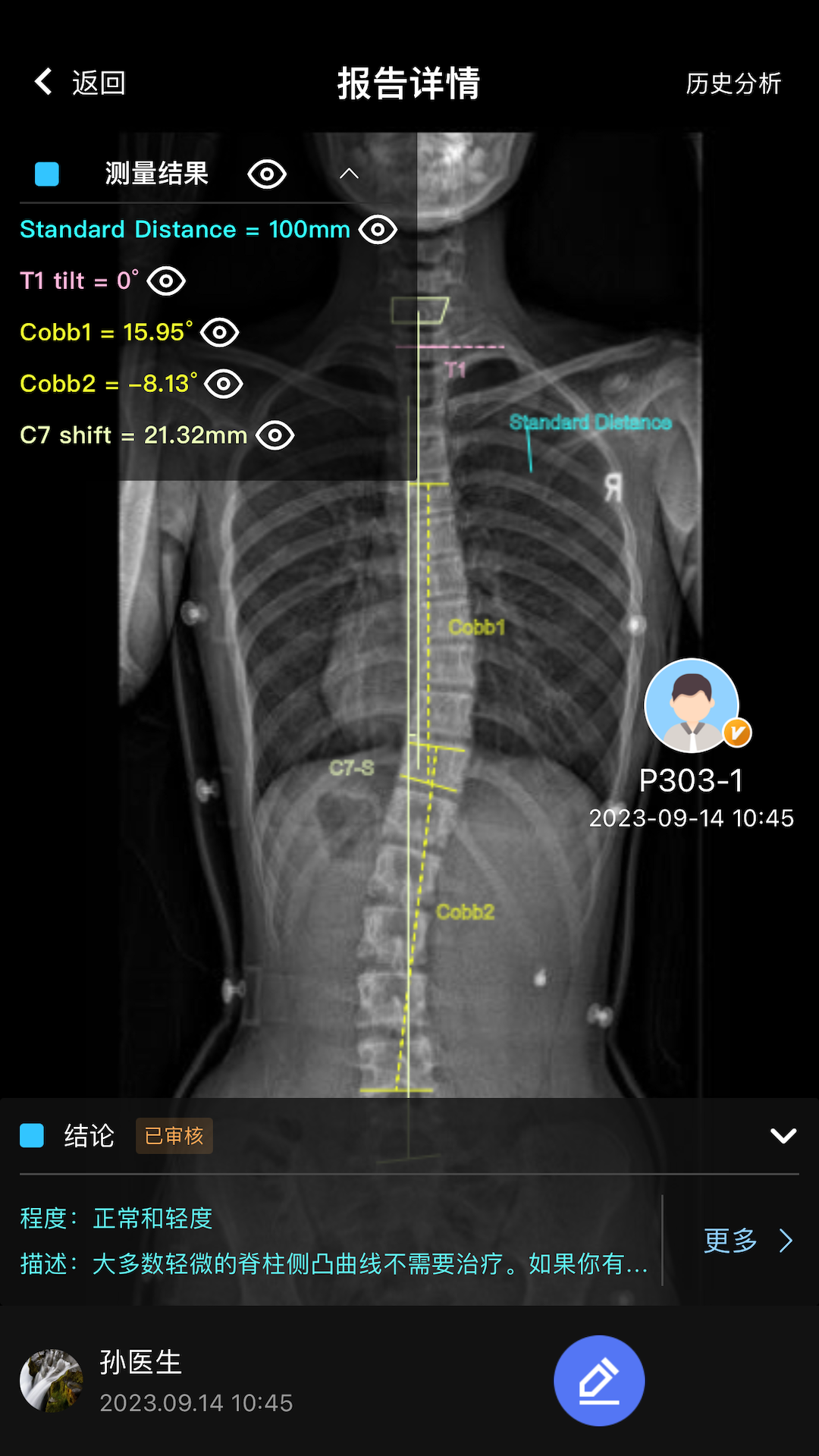 精彩截图-AlignProCARE2026官方新版