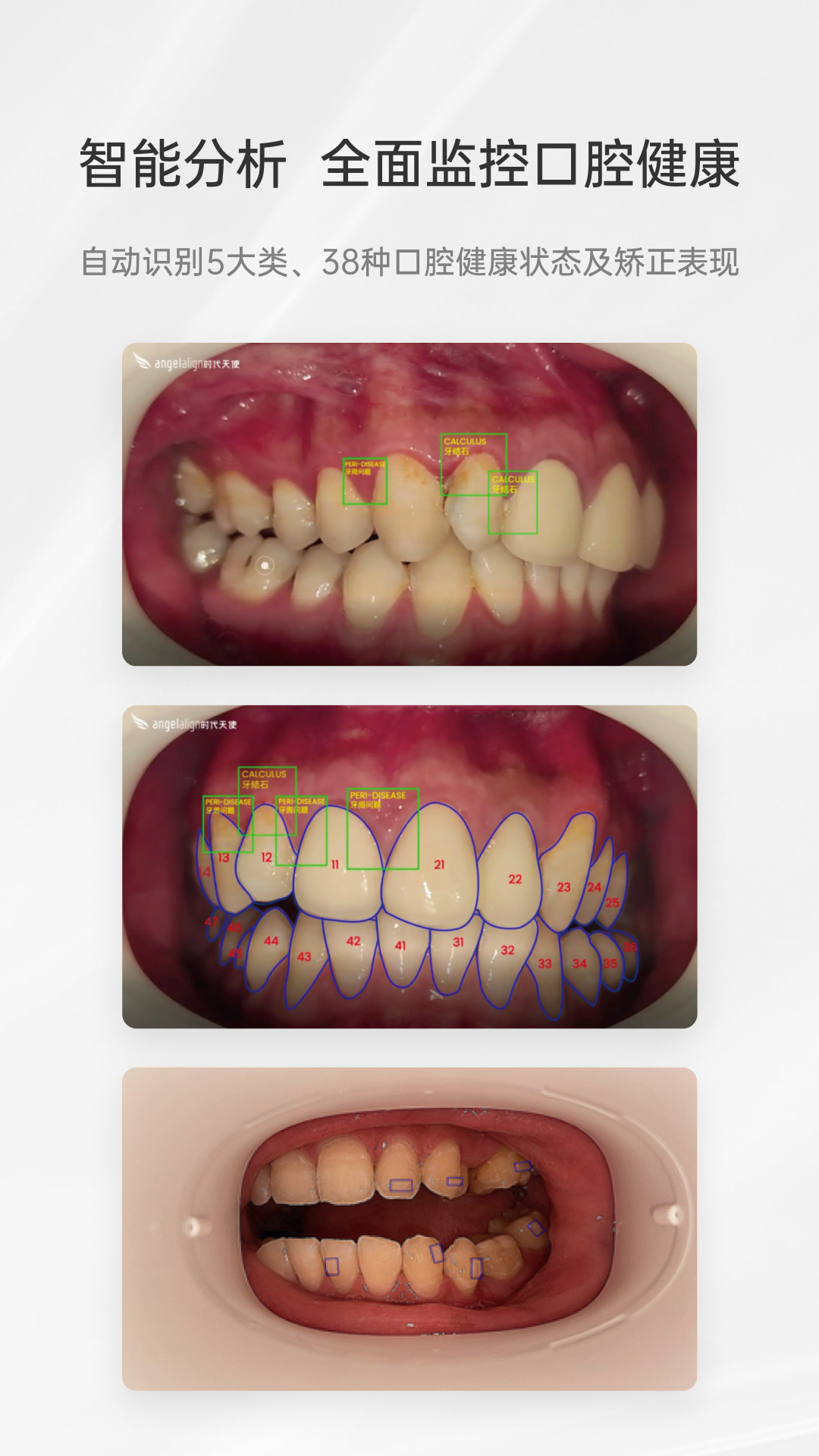 精彩截图-乐齿拍2026官方新版