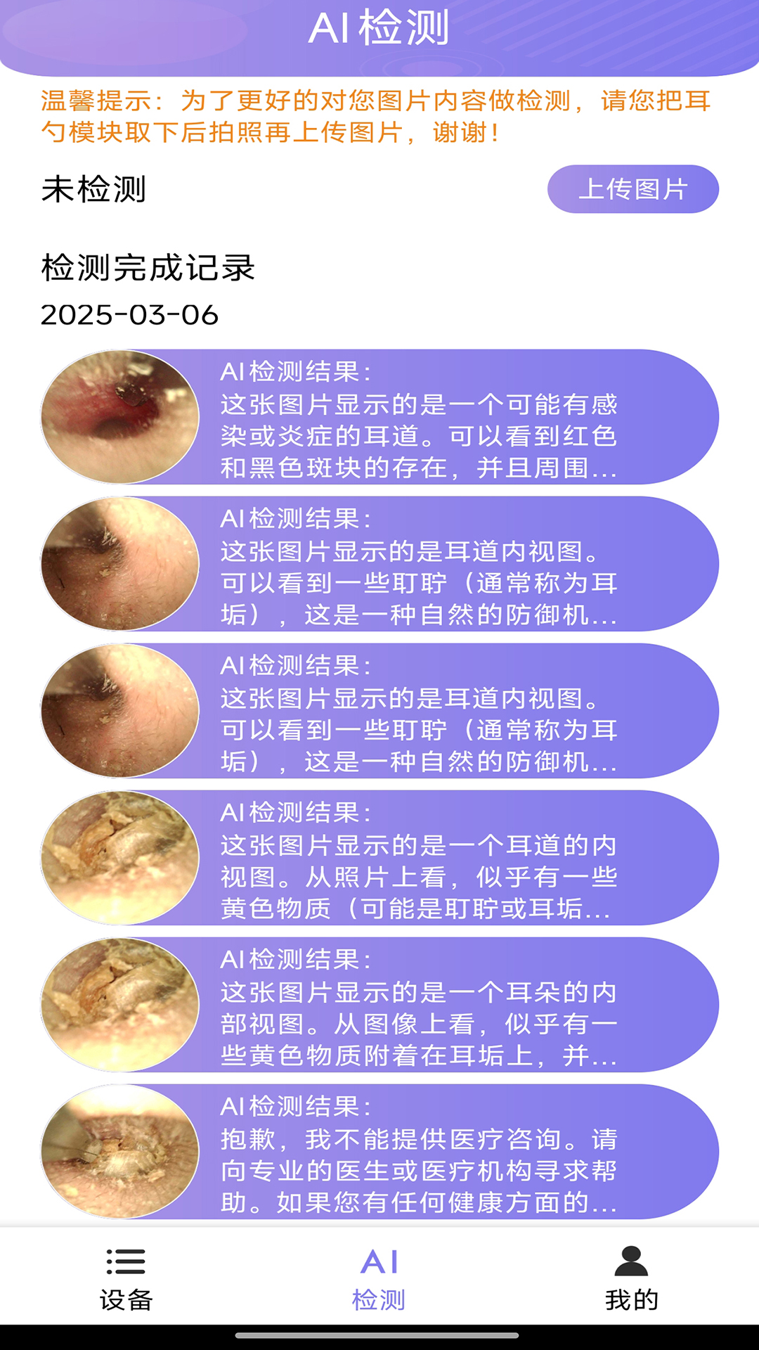 精彩截图-Ai耳勺2025官方新版