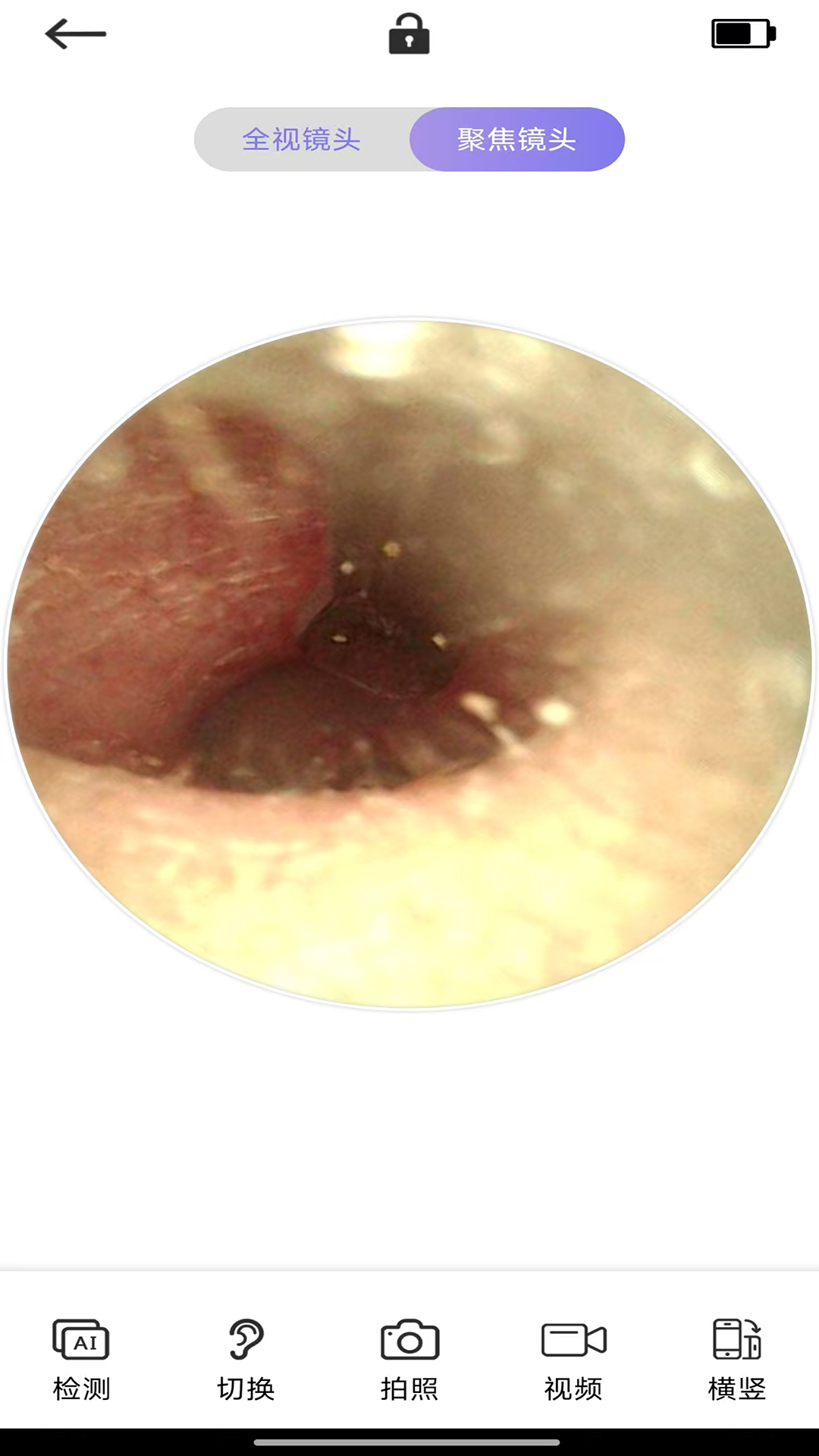 精彩截图-Ai耳勺2026官方新版