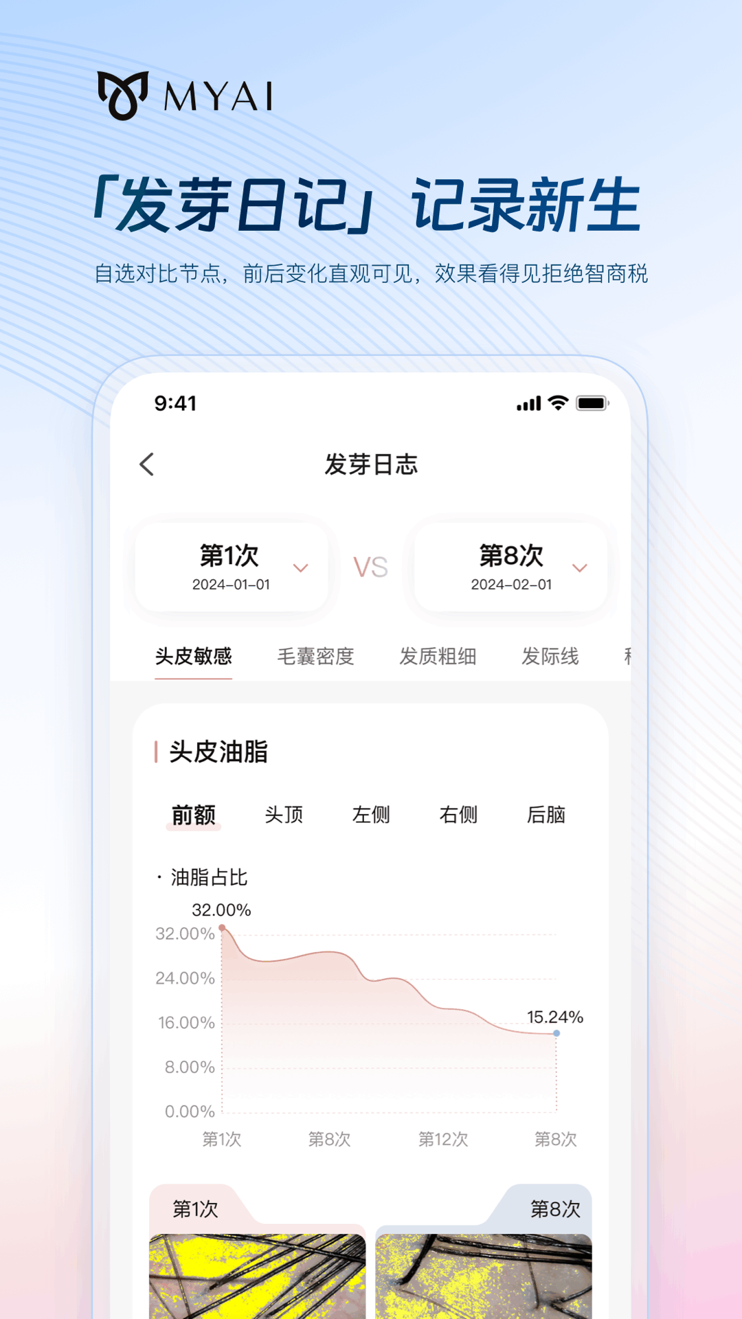 精彩截图-MYAI护发日记2026官方新版