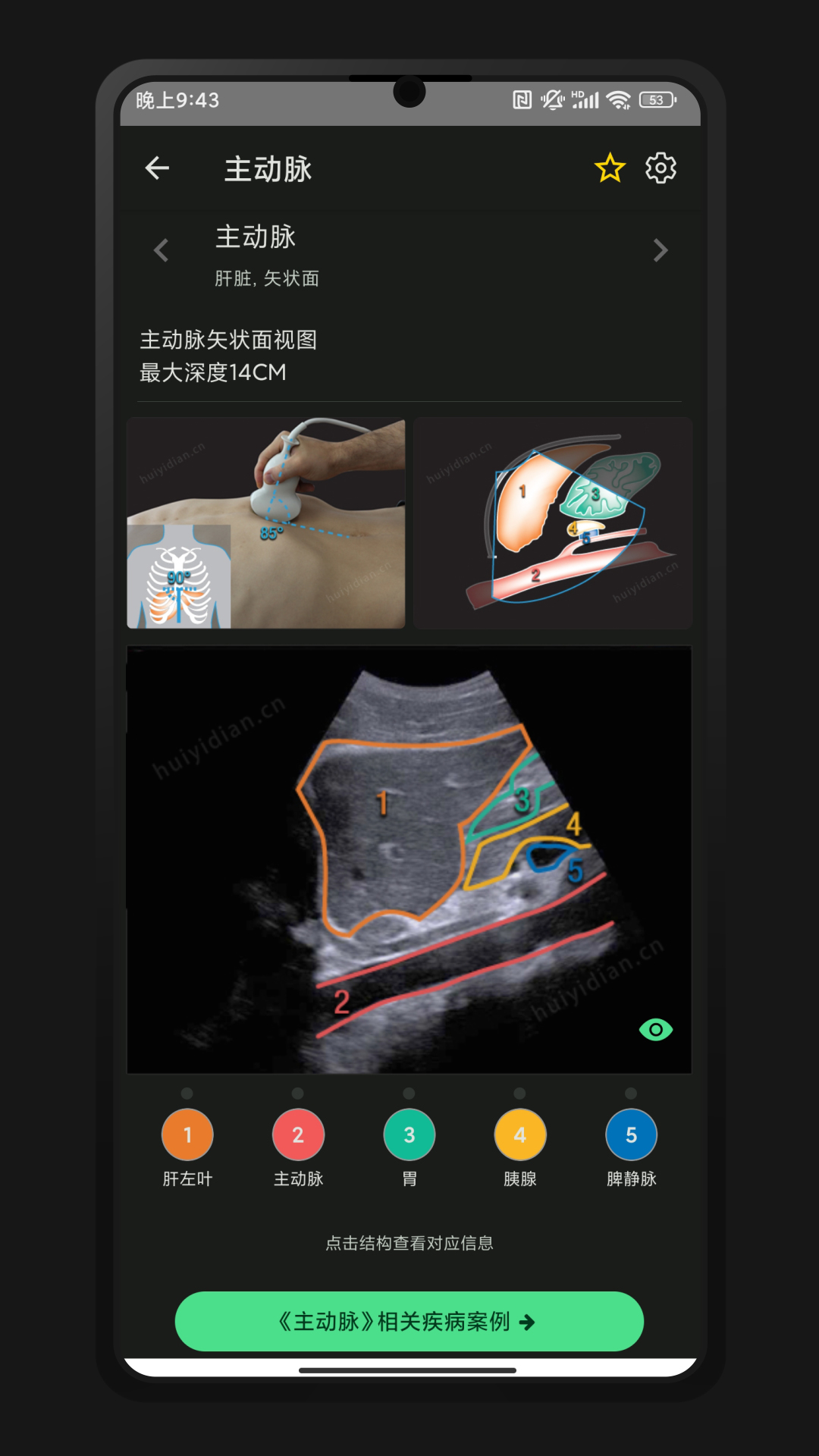 精彩截图-超声智学2026官方新版