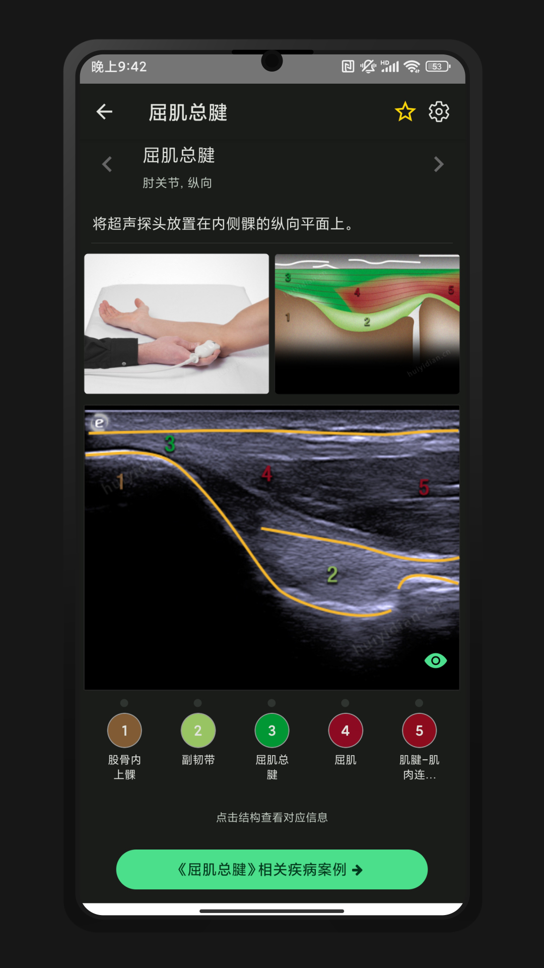 精彩截图-超声智学2026官方新版