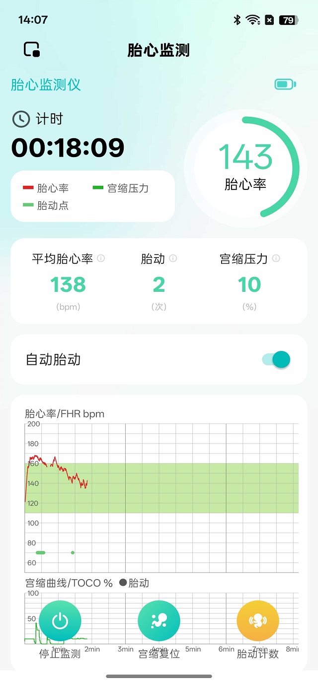 精彩截图-喜芽Pro2026官方新版