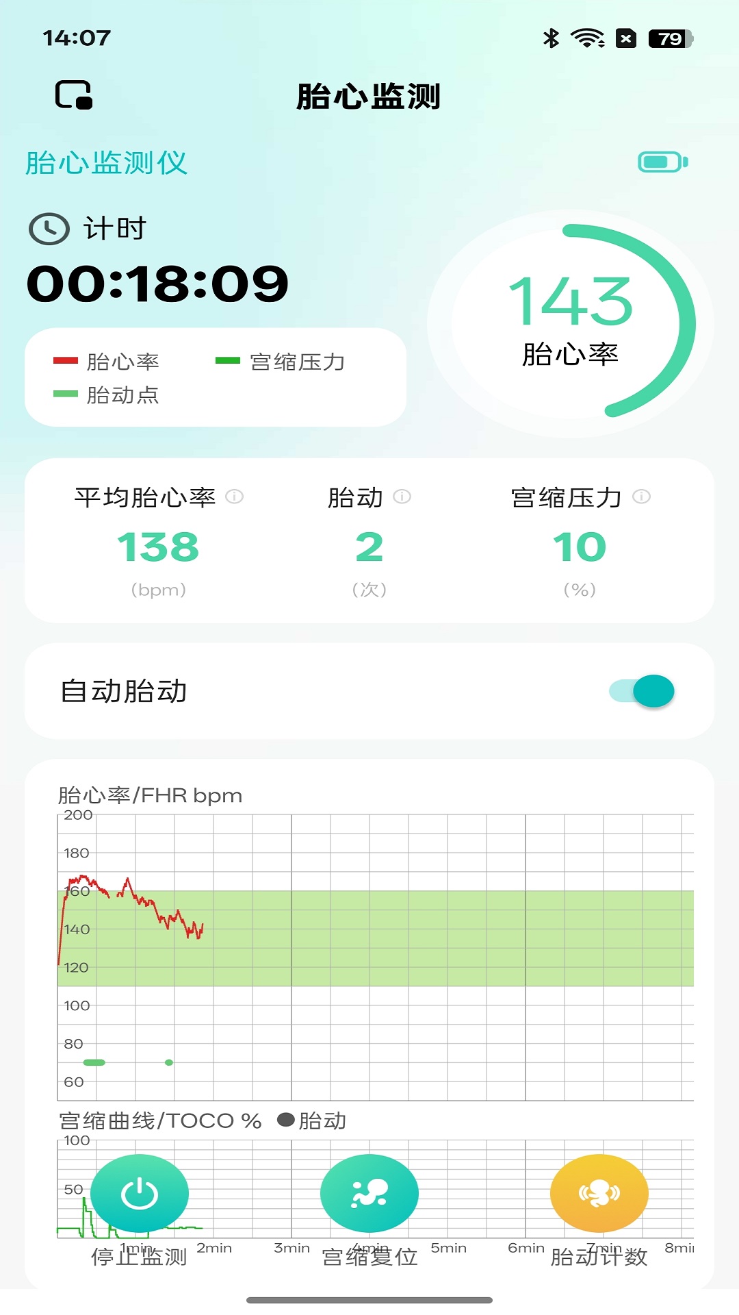 精彩截图-喜芽Pro2026官方新版