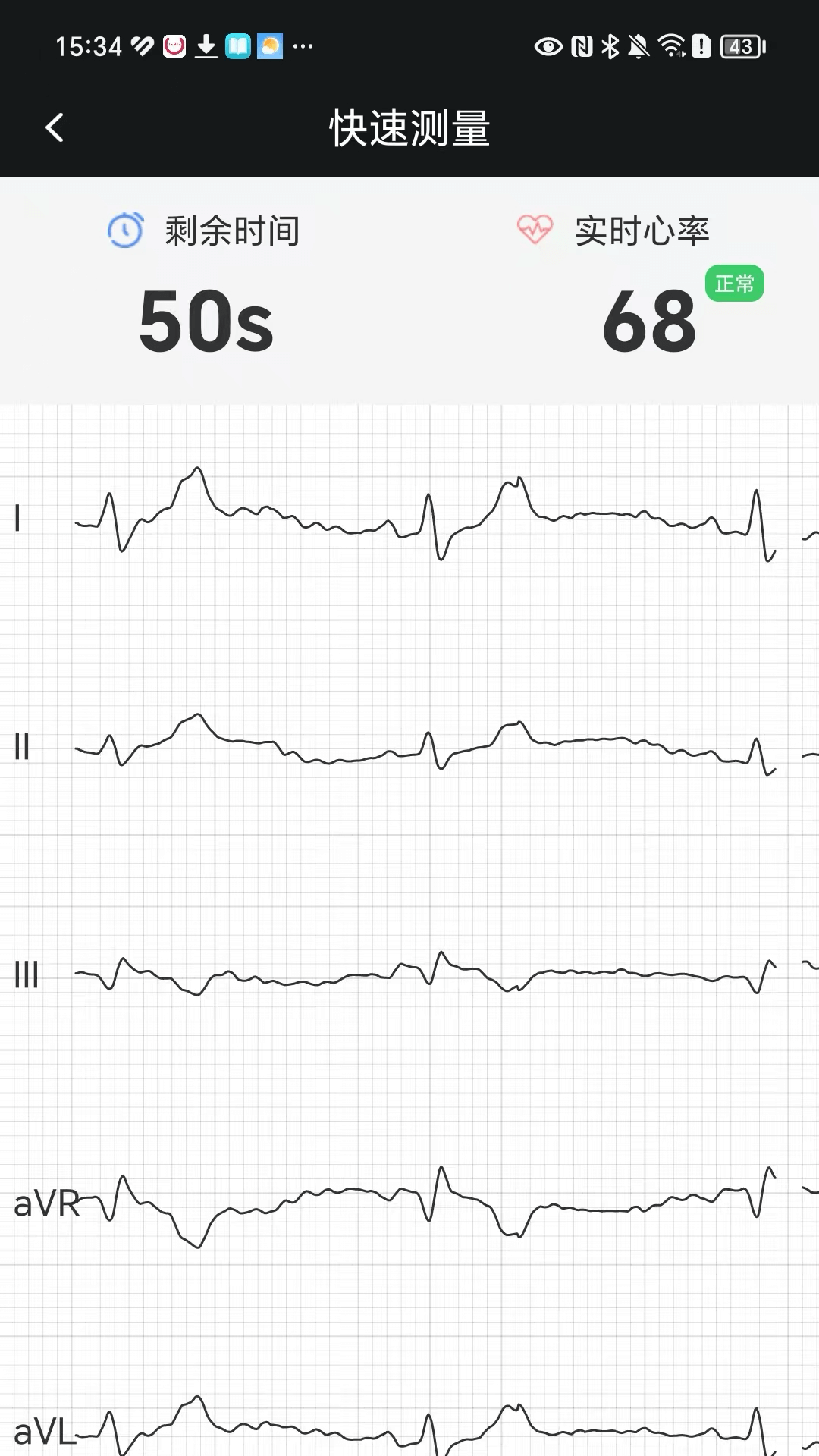 精彩截图-鱼跃心电2026官方新版
