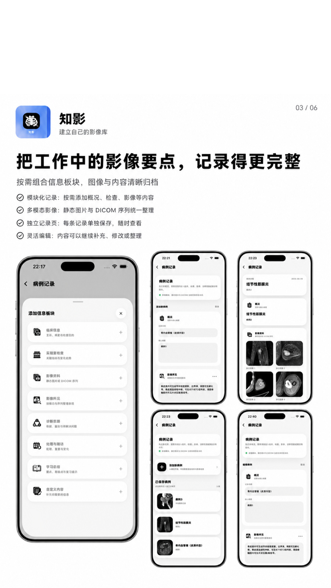 精彩截图-知影2026官方新版